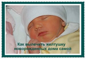 желтушка грудничков:лечение
